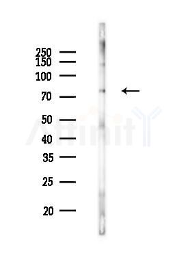 Phospho-TIF1 alpha (Ser649) Antibody - Western blot analysis of lysates from Rat brain, using Phospho-TIF1 alpha (Ser649) Antibody at 1/1000 dilution.