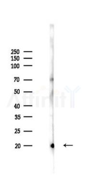 TPD52L1 Antibody - Western blot analysis of lysates from Rat testis, using TPD52L1 Antibody at 1/1000 dilution.