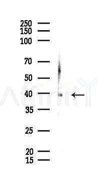 MBIP1 Antibody - Western blot analysis of lysates from K562 cells(UV 30min treatment), using MBIP1 Antibody at 1/1000 dilution.