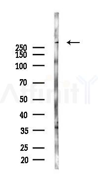 Collagen VII  alpha 1 Antibody - Western blot analysis of lysates from Rat brain, using Collagen VII  alpha 1 Antibody at 1/1000 dilution.