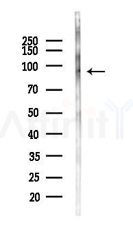 Collagen IX  alpha 1 Antibody - Western blot analysis of lysates from Mouse liver, using Collagen IX  alpha 1 Antibody at 1/1000 dilution.