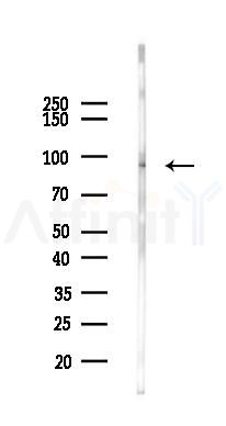 Collagen IX  alpha 1 Antibody - Western blot analysis of lysates from Rat liver, using Collagen IX  alpha 1 Antibody at 1/1000 dilution.