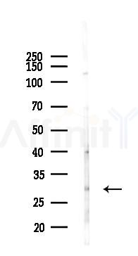 CIDEC Antibody - Western blot analysis of lysates from Hela cells, using CIDEC Antibody at 1/1000 dilution.