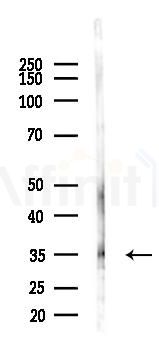 CIDEC Antibody - Western blot analysis of lysates from HUVEC cells(starvation 24h treatment), using CIDEC Antibody at 1/1000 dilution.