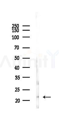 IFNA7 Antibody - Western blot analysis of lysates from Mouse testis, using IFNA7 Antibody at 1/1000 dilution.