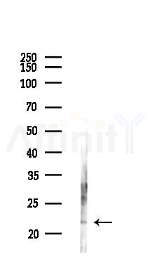 IFNA7 Antibody - Western blot analysis of lysates from Mouse lung, using IFNA7 Antibody at 1/1000 dilution.