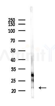 IFNA7 Antibody - Western blot analysis of lysates from HUVEC cells(starvation 24h treatment), using IFNA7 Antibody at 1/1000 dilution.