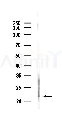 IFNA7 Antibody - Western blot analysis of lysates from Rat lung, using IFNA7 Antibody at 1/1000 dilution.