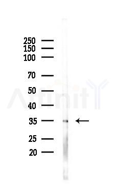 INGR2 Antibody - Western blot analysis of lysates from RAW264.