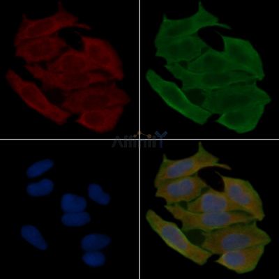 Cytokeratin 6 Antibody - DF9011 staining Hela cells(30min of UV treatment) by IF/ICC.