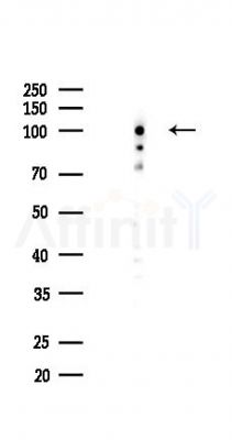 RAD54B Antibody - Western blot analysis of lysates from COLO205 cells(UV 30min treatment), using RAD54B Antibody at 1/1000 dilution.