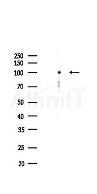 RAD54B Antibody - Western blot analysis of lysates from Mouse lung, using RAD54B Antibody at 1/1000 dilution.