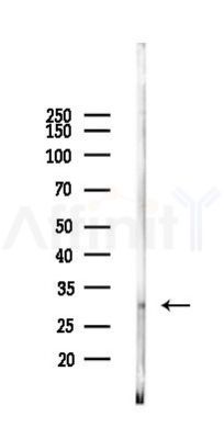 CENPQ Antibody - Western blot analysis of lysates from PC12 cells(starvation 24h treatment), using CENPQ Antibody at 1/1000 dilution.