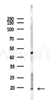 MRPL30 Antibody - Western blot analysis of lysates from Hela cells(starvation 24h treatment), using MRPL30 Antibody at 1/1000 dilution.