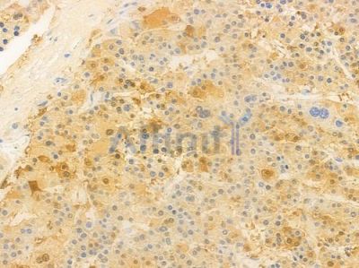 RPL13A Antibody - DF9126 at 1/100 staining human normal liver tissue by IHC-P.