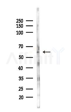 ACVR2B Antibody - Western blot analysis of lysates from Mouse lung, using ACVR2B Antibody at 1/1000 dilution.