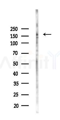 ADAMTS12 Antibody - Western blot analysis of lysates from Hela cells(starvation 24h treatment), using ADAMTS12 Antibody at 1/1000 dilution.