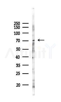 ACCN2 Antibody - Western blot analysis of lysates from 293 cells(UV 30min treatment), using ACCN2 Antibody at 1/1000 dilution.