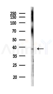 ATXN7L3 Antibody - Western blot analysis of lysates from EC304 cells(UV 30min treatment), using ATXN7L3 Antibody at 1/1000 dilution.