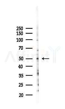 KCNJ8 Antibody - Western blot analysis of lysates from 293 cells(LPS 4h treatment), using KCNJ8 Antibody at 1/1000 dilution.