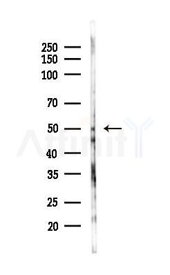 KCNJ8 Antibody - Western blot analysis of lysates from Rat testis, using KCNJ8 Antibody at 1/1000 dilution.