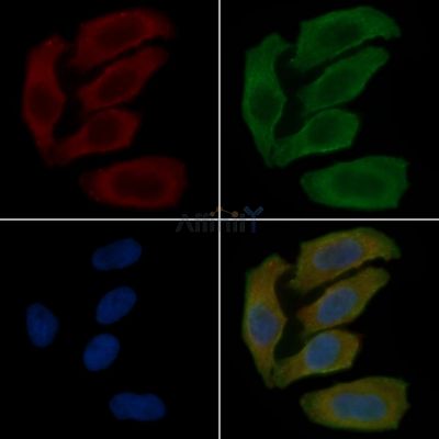 KCNMB1 Antibody - DF9301 staining Hela cells(30min of UV treatment) by IF/ICC.