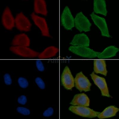 CA8 Antibody - DF9333 staining Hela cells(30min of UV treatment) by IF/ICC.