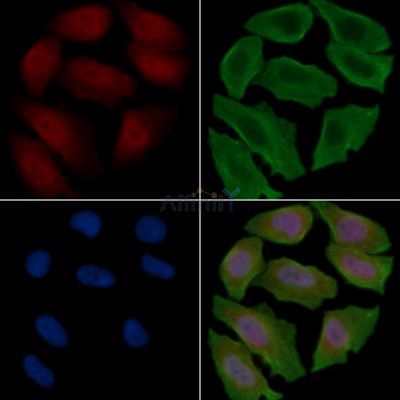 PDE5A Antibody - DF9373 staining Hela cells(30min of UV treatment) by IF/ICC.