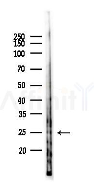 CMTM5 Antibody - Western blot analysis of lysates from RAW264.