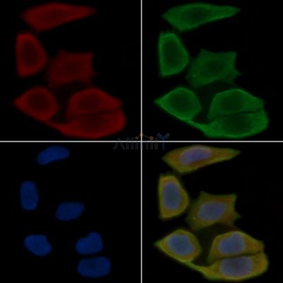 CLDN18 Antibody - DF9392 staining Hela cells(30min of UV treatment) by IF/ICC.