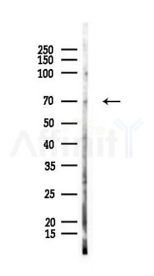 Factor XIa/F11 Antibody - Western blot analysis of lysates from K562 cells(UV 30min treatment), using Factor XIa/F11 Antibody at 1/1000 dilution.