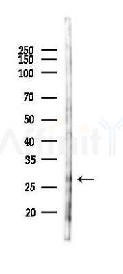 DHRS11 Antibody - Western blot analysis of lysates from HUVEC cells(starvation 24h treatment), using DHRS11 Antibody at 1/1000 dilution.