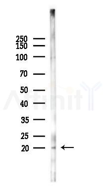 RNF5 Antibody - Western blot analysis of lysates from Hela cells(starvation 24h treatment), using RNF5 Antibody at 1/1000 dilution.