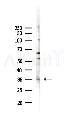 NTHL1 Antibody - Western blot analysis of lysates from PC12 cells(LPS 4h treatment), using NTHL1 Antibody at 1/1000 dilution.