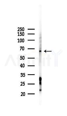 TRIM23 Antibody - Western blot analysis of lysates from HUVEC cells(starvation 24h treatment), using TRIM23 Antibody at 1/1000 dilution.