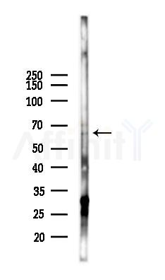 TRIM23 Antibody - Western blot analysis of lysates from Hela cells(starvation 24h treatment), using TRIM23 Antibody at 1/1000 dilution.