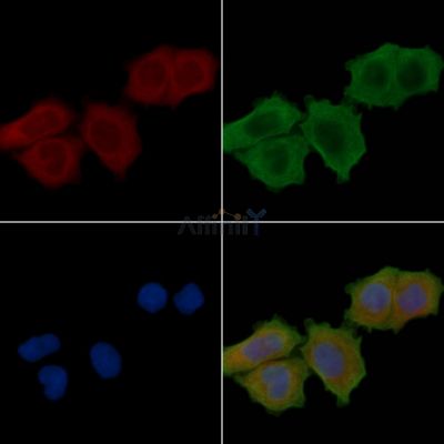 HGFAC Antibody - DF9570 staining Hela cells(30min of UV treatment) by IF/ICC.
