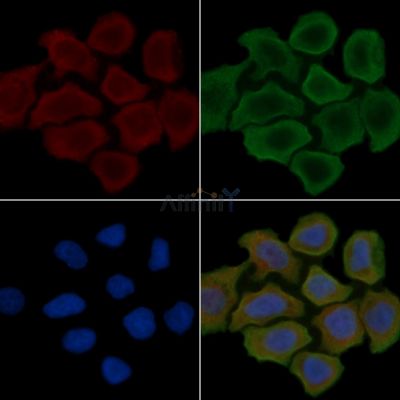 IMMP2L Antibody - DF9630 staining Hela cells(30min of UV treatment) by IF/ICC.