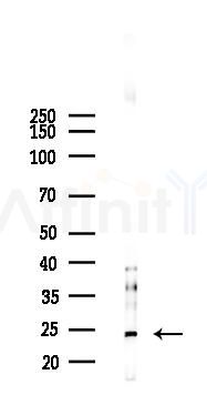 SCG5 Antibody - Western blot analysis of lysates from Hela cells(starvation 24h treatment), using SCG5 Antibody at 1/1000 dilution.