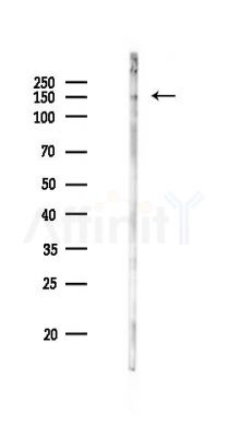 PRDM10 Antibody - Western blot analysis of lysates from Rat brain, using PRDM10 Antibody at 1/1000 dilution.