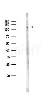 PRDM10 Antibody - Western blot analysis of lysates from COLO205 cells(heat-shock 45min treatment), using PRDM10 Antibody at 1/1000 dilution.