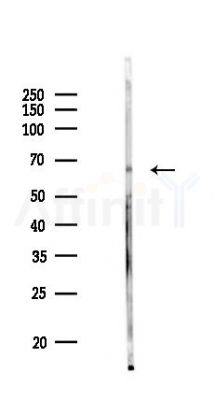 RFTN2 Antibody - Western blot analysis of lysates from K562 cells(UV 30min treatment), using RFTN2 Antibody at 1/1000 dilution.