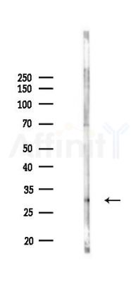 SHOX Antibody - Western blot analysis of lysates from Rat brain, using SHOX Antibody at 1/1000 dilution.
