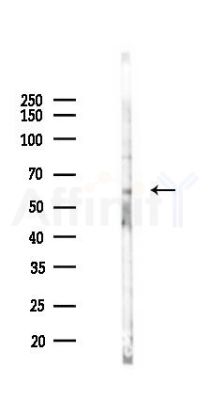 SLC6A20 Antibody - Western blot analysis of lysates from Mouse testis, using SLC6A20 Antibody at 1/1000 dilution.