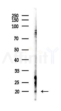 BTF3L2 Antibody - Western blot analysis of lysates from EC304 cells(starvation 24h treatment), using BTF3L2 Antibody at 1/1000 dilution.