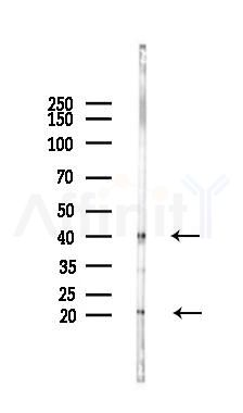 CD28 Antibody - Western blot analysis of lysates from B16F10-LUC cells(LPS 4h treatment), using CD28 Antibody at 1/1000 dilution.