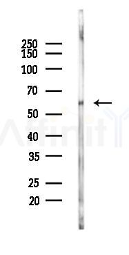 Phospho-AKT1/2/3 (Ser473) Antibody - Western blot analysis of lysates from Mouse lung, using Phospho-AKT1/2/3 (Ser473) Antibody at 1/1000 dilution.