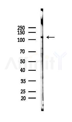 EPHA2/3/4 Antibody - Western blot analysis of lysates from K562 cells(LPS 4h treatment), using EPHA2/3/4 Antibody at 1/1000 dilution.