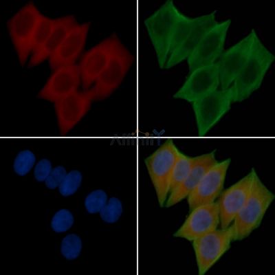 EPHA2/3/4 Antibody - AF0089 staining Hela cells(30min of UV treatment) by IF/ICC.