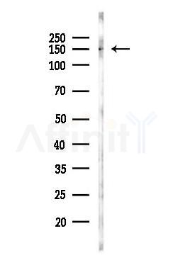 eNOS Antibody - Western blot analysis of lysates from Mouse heart, using eNOS Antibody at 1/1000 dilution.